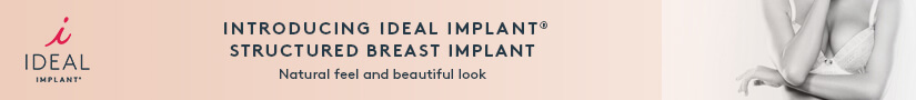 ideal-implant-a