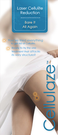 Cellulaze Cellulaze