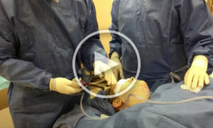 Neck Liposuction Surgical Procedure with Dr. Shah