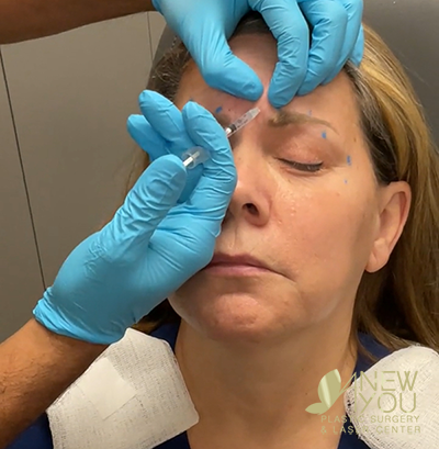 Dr. Shah Injecting Neurotoxin Botox